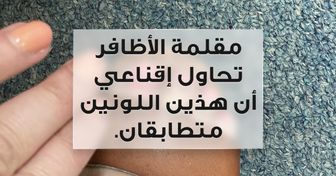+20 شخصاً عاشوا مواقف مستفزة كادت أن تسبب لهم انهيارات عصبيّة