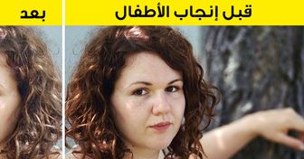 8 تغيرات جسدية غريبة تطرأ على المرأة بعد إنجاب الأطفال