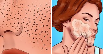 8 أخطاء في العناية بالبشرة تسبب توسّع المسامات