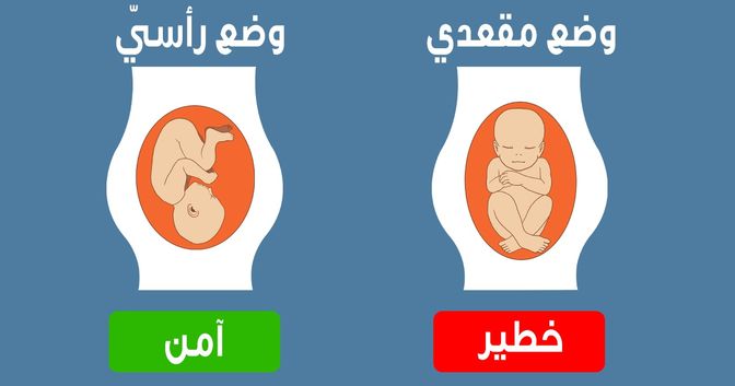 ما الذي تخبرنا به وضعيات الجنين المختلفة أثناء الحمل